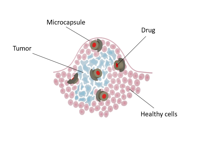 Des microcapsules pour combattre les cancers