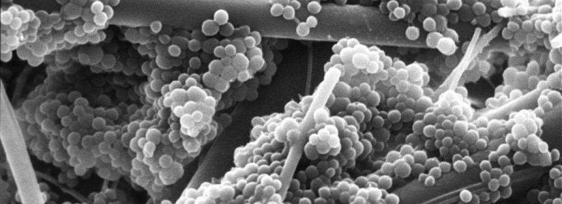 Découverte d’un mécanisme de survie du staphylocoque doré dans le sang