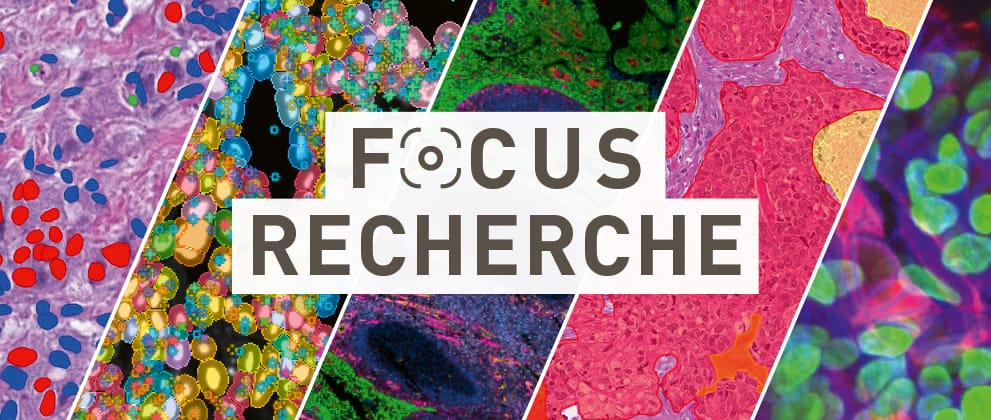 Focus recherche : trois autres avancées à suivre