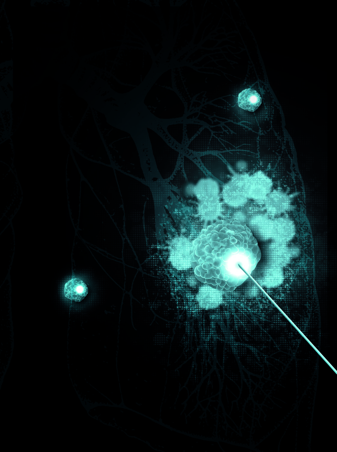 NATURE - INTRA-TUMOUR IMMUNOTHERAPY: MOBILISING THE IMMUNE SYSTEM AGAINST CANCER WHILE AVOIDING TOXICITY TO THE BODY